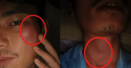 YFK assaulted in Wokha during cash exchange dispute